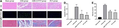 Shuangxinfang Prevents S100A9-Induced Macrophage/Microglial Inflammation to Improve Cardiac Function and Depression-Like Behavior in Rats After Acute Myocardial Infarction